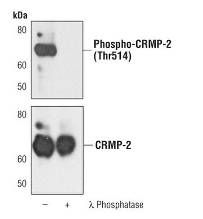 Phospho-CRMP2 (Thr514) Antibody in Western Blot (WB)