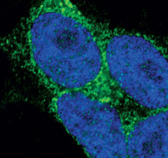 STIM2 Antibody in Immunocytochemistry (ICC/IF)