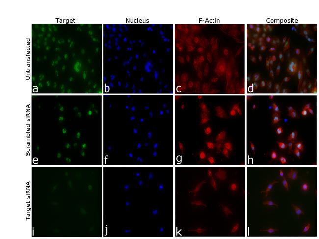 JMJD1B Antibody in Immunocytochemistry (ICC/IF)