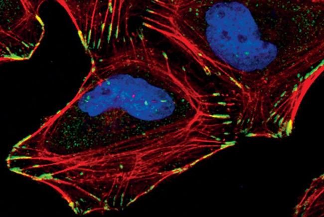 PARVA Antibody in Immunocytochemistry (ICC/IF)