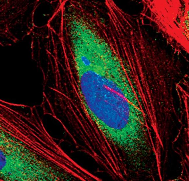 EEF1A1 Antibody in Immunocytochemistry (ICC/IF)