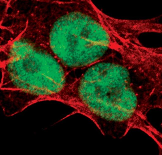 UBE1 Isoform A Antibody in Immunocytochemistry (ICC/IF)