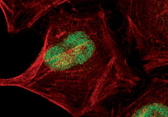 JunB Antibody in Immunocytochemistry (ICC/IF)