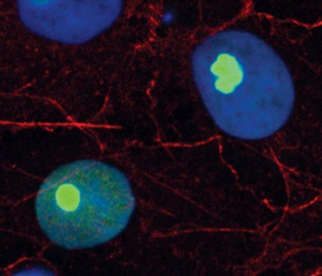 RPL7A Antibody in Immunocytochemistry (ICC/IF)