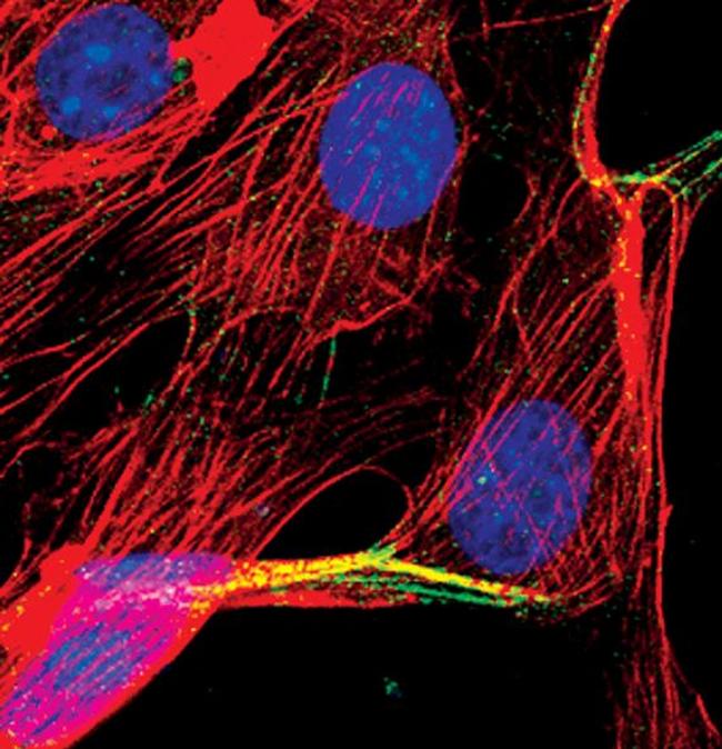 alpha Actinin 1 Antibody in Immunocytochemistry (ICC/IF)