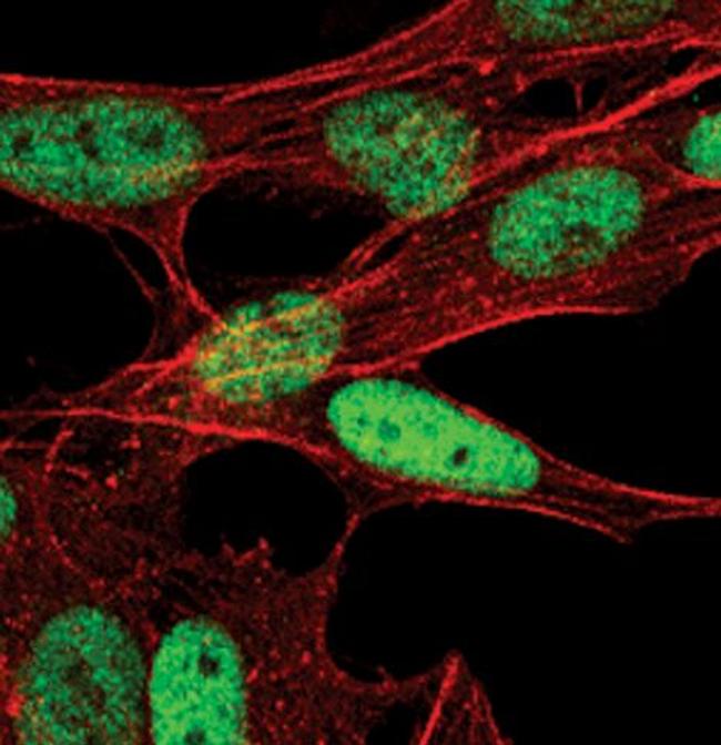 AP2 beta Antibody in Immunocytochemistry (ICC/IF)