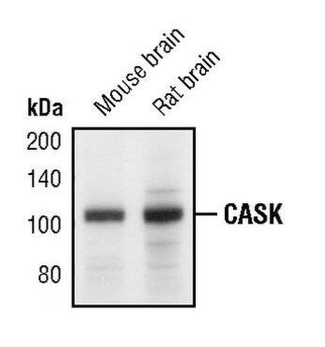 CASK Antibody in Western Blot (WB)