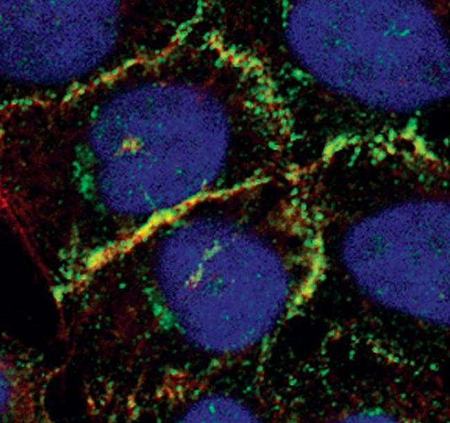 Catenin alpha-1 Antibody in Immunocytochemistry (ICC/IF)