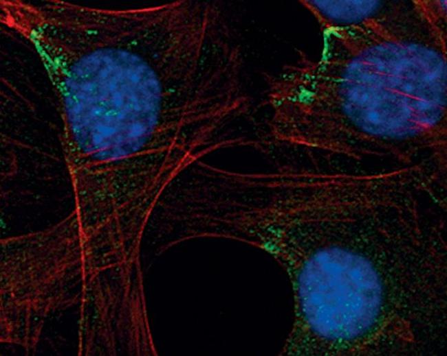 Profilin 1 Antibody in Immunocytochemistry (ICC/IF)