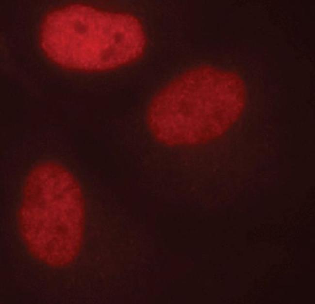 FosB Antibody in Immunocytochemistry (ICC/IF)