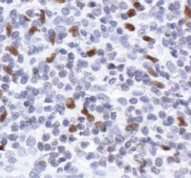 PU.1 Antibody in Immunohistochemistry (Paraffin) (IHC (P))