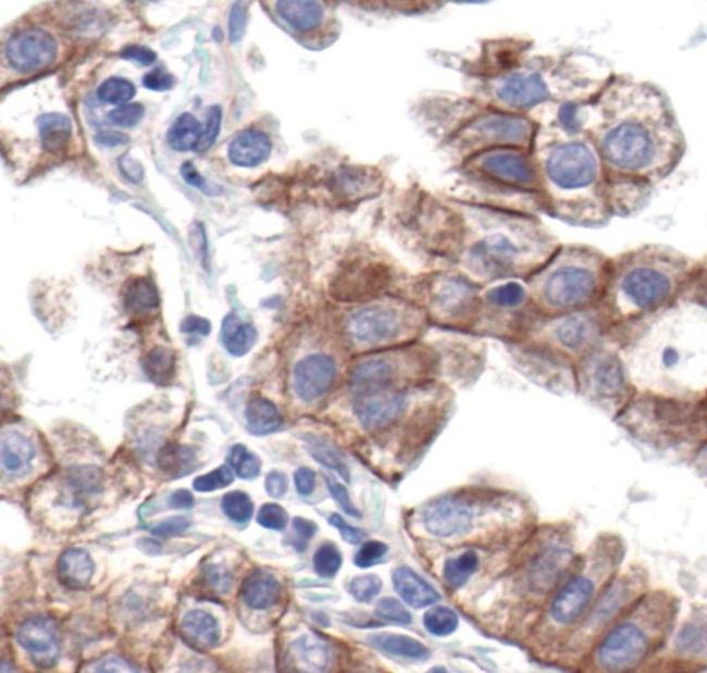 N-cadherin Antibody in Immunohistochemistry (Paraffin) (IHC (P))