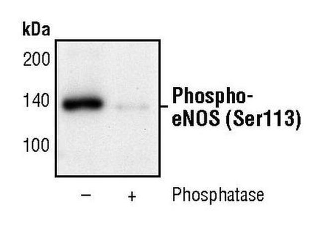 Phospho-eNOS (Ser113) Antibody in Western Blot (WB)