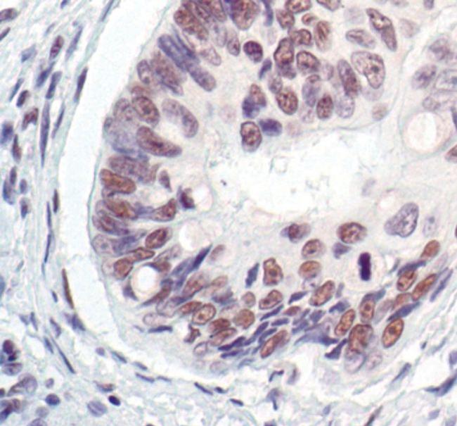 MRE11 Antibody in Immunohistochemistry (Paraffin) (IHC (P))