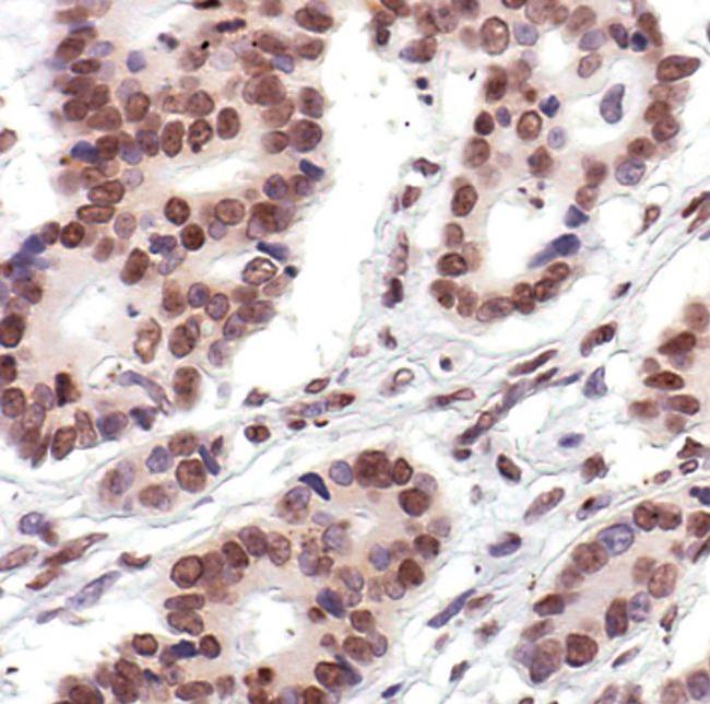 Histone H2A Antibody in Immunohistochemistry (Paraffin) (IHC (P))