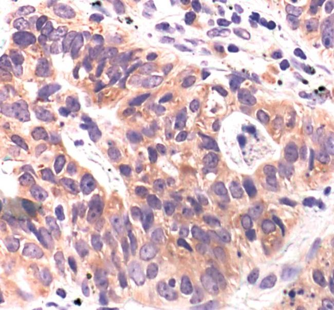 APS Antibody in Immunohistochemistry (Paraffin) (IHC (P))