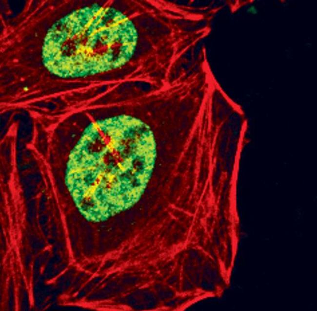 Phospho-Glucocorticoid Receptor (Ser211) Antibody in Immunocytochemistry (ICC/IF)