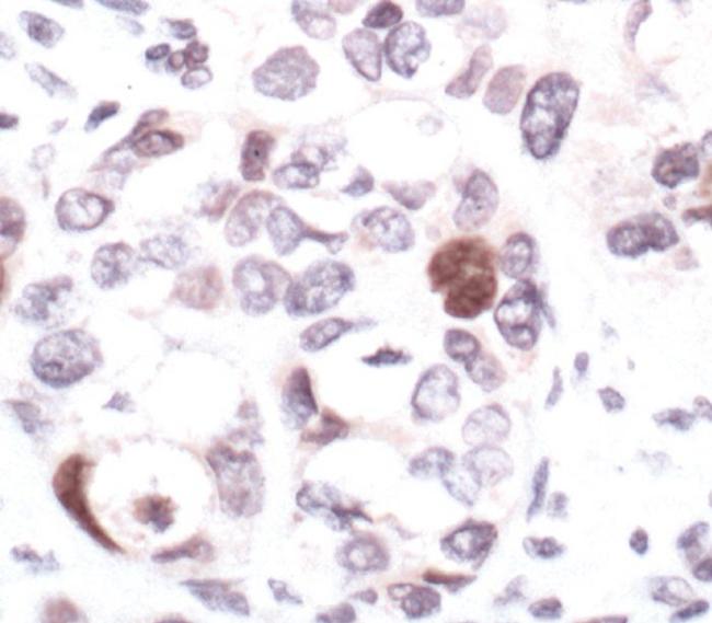 Phospho-CHK2 (Ser19) Antibody in Immunohistochemistry (Paraffin) (IHC (P))