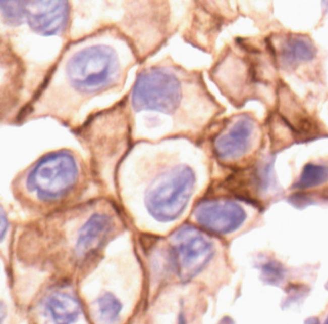 Phospho-SRC (Tyr527) Antibody in Immunohistochemistry (Paraffin) (IHC (P))