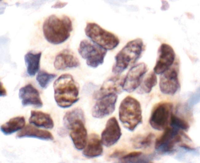 Phospho-MAPKAPK2 (Thr334) Antibody in Immunohistochemistry (Paraffin) (IHC (P))