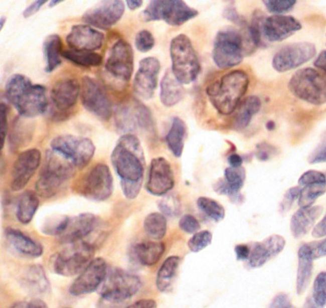 Phospho-PKC delta/theta (Ser643, Ser676) Antibody in Immunohistochemistry (Paraffin) (IHC (P))