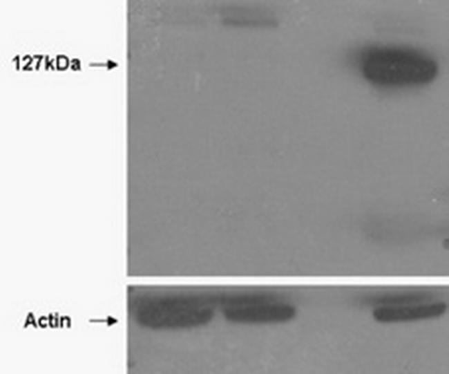 Tankyrase 2 Antibody in Western Blot (WB)