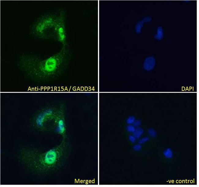 GADD34 Antibody in Immunocytochemistry (ICC/IF)