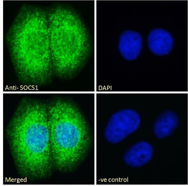 SOCS1 Antibody in Immunocytochemistry (ICC/IF)