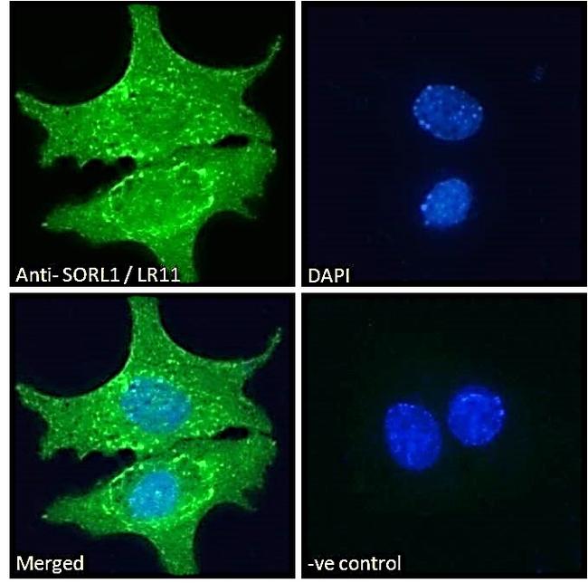 SORL1 Antibody in Immunocytochemistry (ICC/IF)