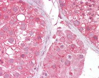 MCT2 Antibody in Immunohistochemistry (Paraffin) (IHC (P))