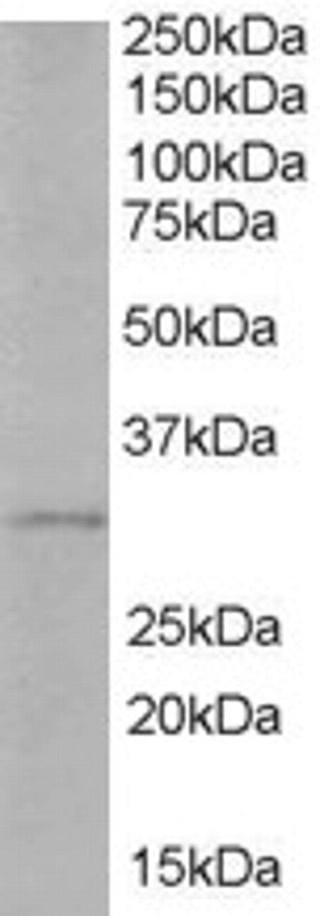 TIRAP Antibody in Western Blot (WB)