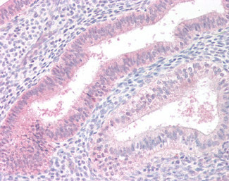 MTM1 Antibody in Immunohistochemistry (Paraffin) (IHC (P))