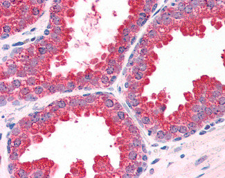 MKP-1 Antibody in Immunohistochemistry (Paraffin) (IHC (P))