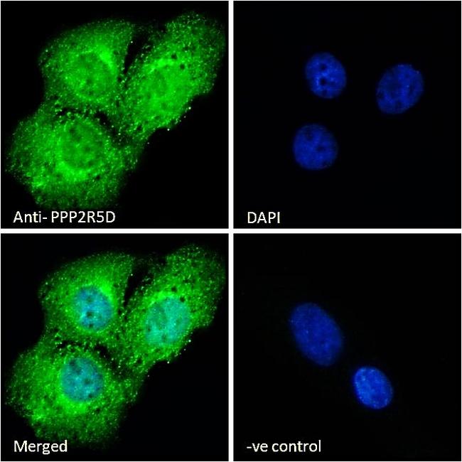 PPP2R5D Antibody in Immunocytochemistry (ICC/IF)