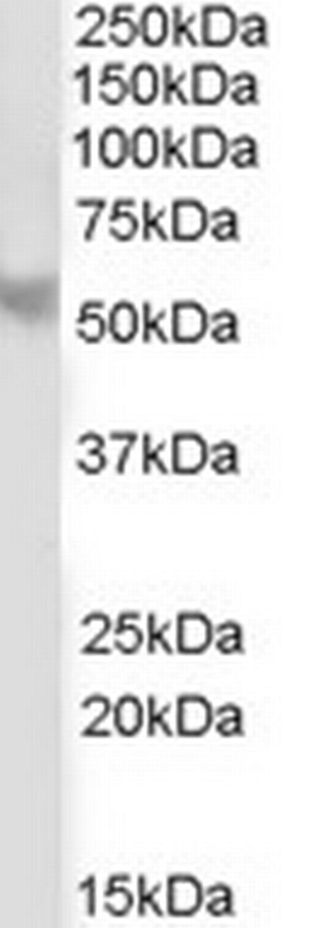 PPP2R5B Antibody in Western Blot (WB)