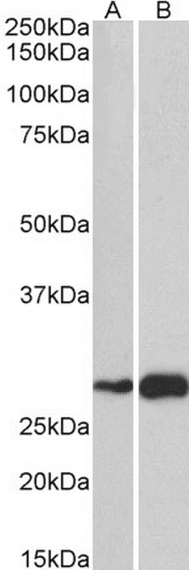 ATF5 Antibody in Western Blot (WB)