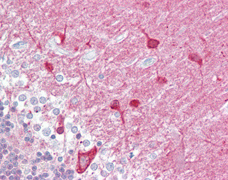 PACSIN1 Antibody in Immunohistochemistry (Paraffin) (IHC (P))