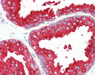 ELMO3 Antibody in Immunohistochemistry (Paraffin) (IHC (P))