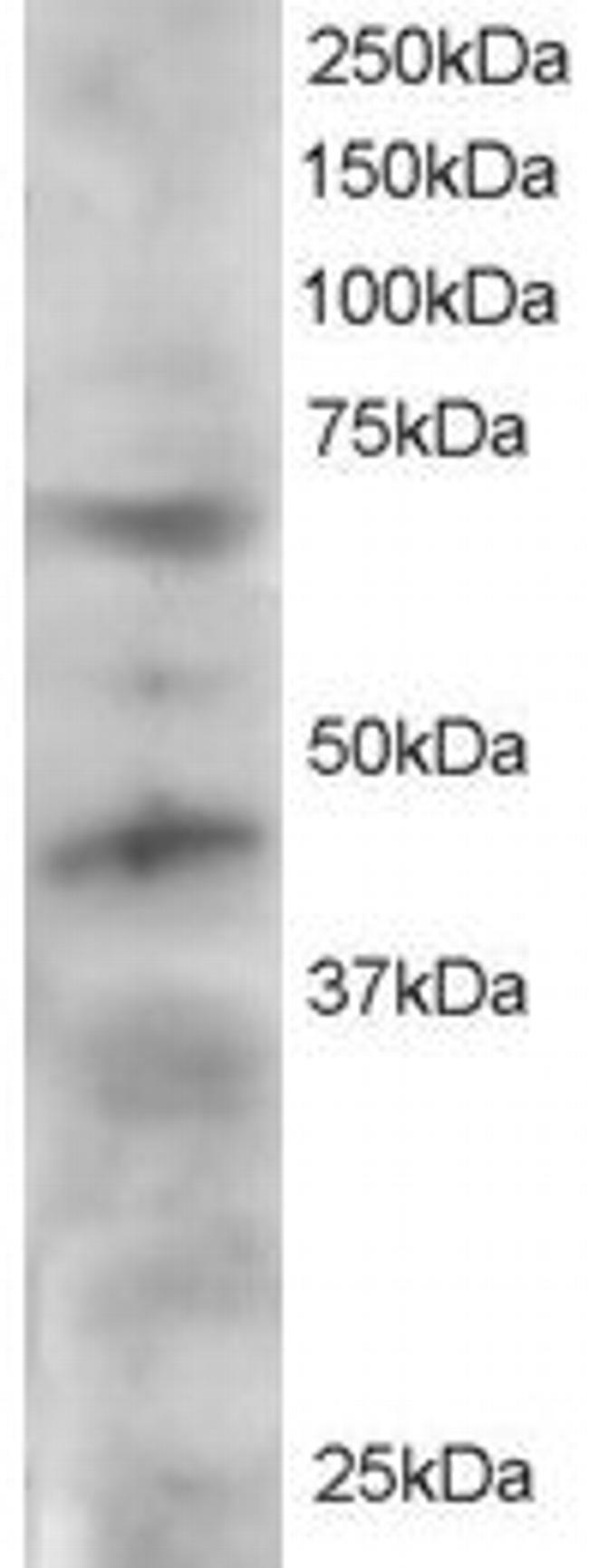 TRF1 Antibody in Western Blot (WB)