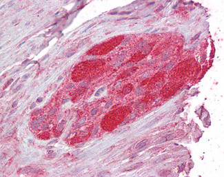 STUB1 Antibody in Immunohistochemistry (Paraffin) (IHC (P))