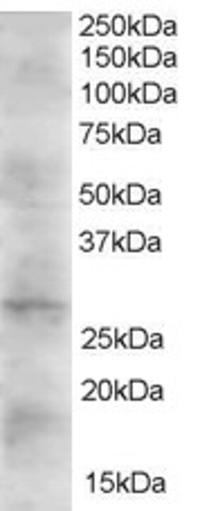 DKK2 Antibody in Western Blot (WB)