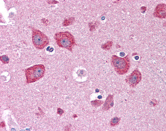 DKK3 Antibody in Immunohistochemistry (Paraffin) (IHC (P))