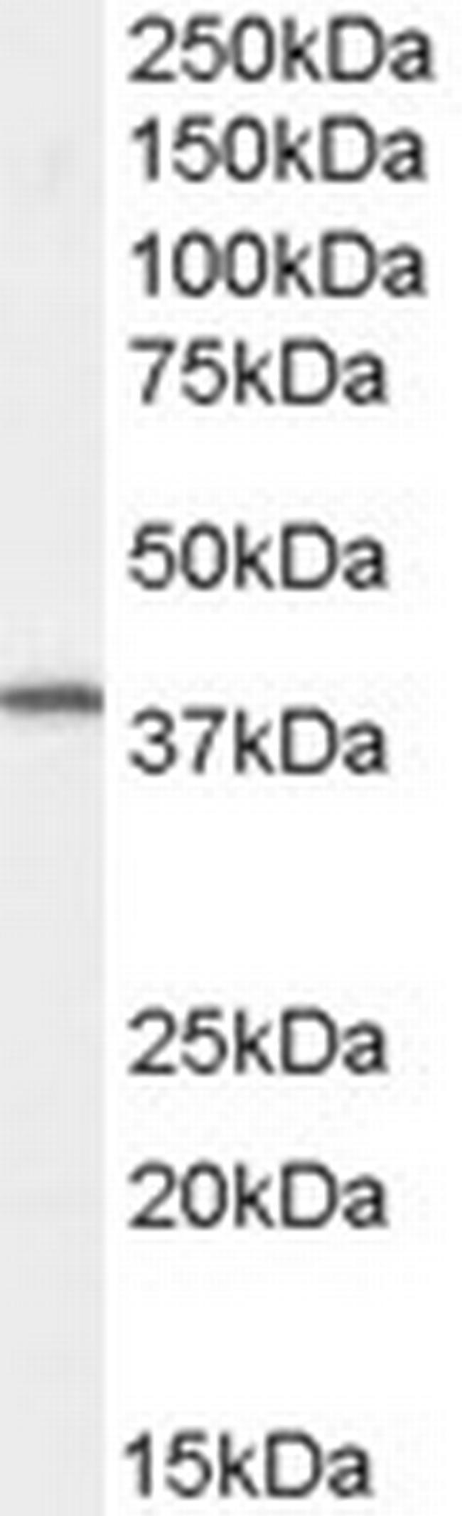 Dysadherin Antibody in Western Blot (WB)