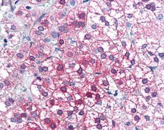 AXIN1 Antibody in Immunohistochemistry (Paraffin) (IHC (P))