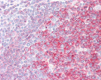 SWAP70 Antibody in Immunohistochemistry (Paraffin) (IHC (P))