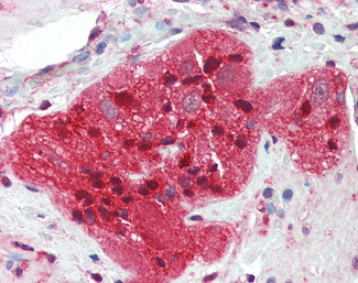 STMN2 Antibody in Immunohistochemistry (Paraffin) (IHC (P))