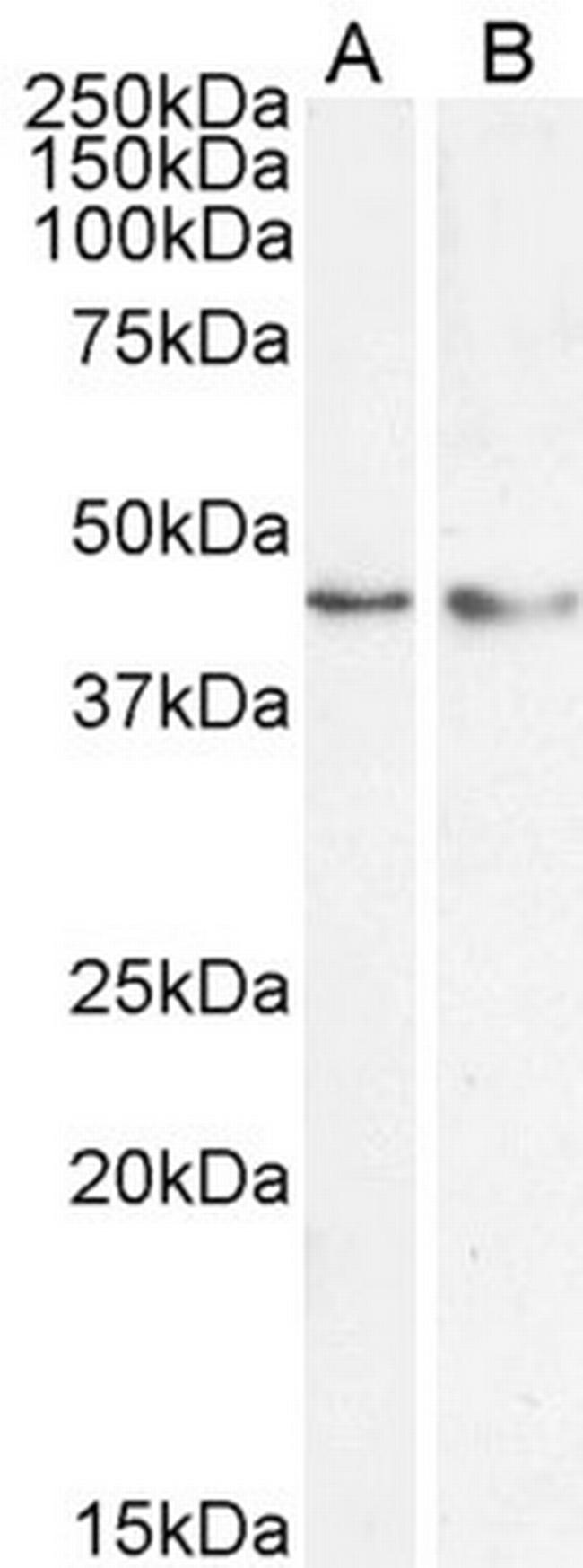 KLF15 Antibody in Western Blot (WB)