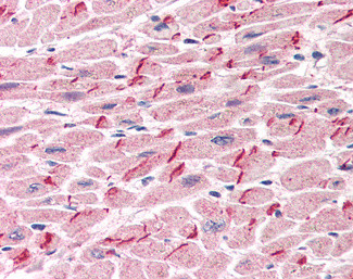 gamma Catenin Antibody in Immunohistochemistry (Paraffin) (IHC (P))