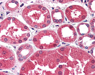 AKR1A1 Antibody in Immunohistochemistry (Paraffin) (IHC (P))