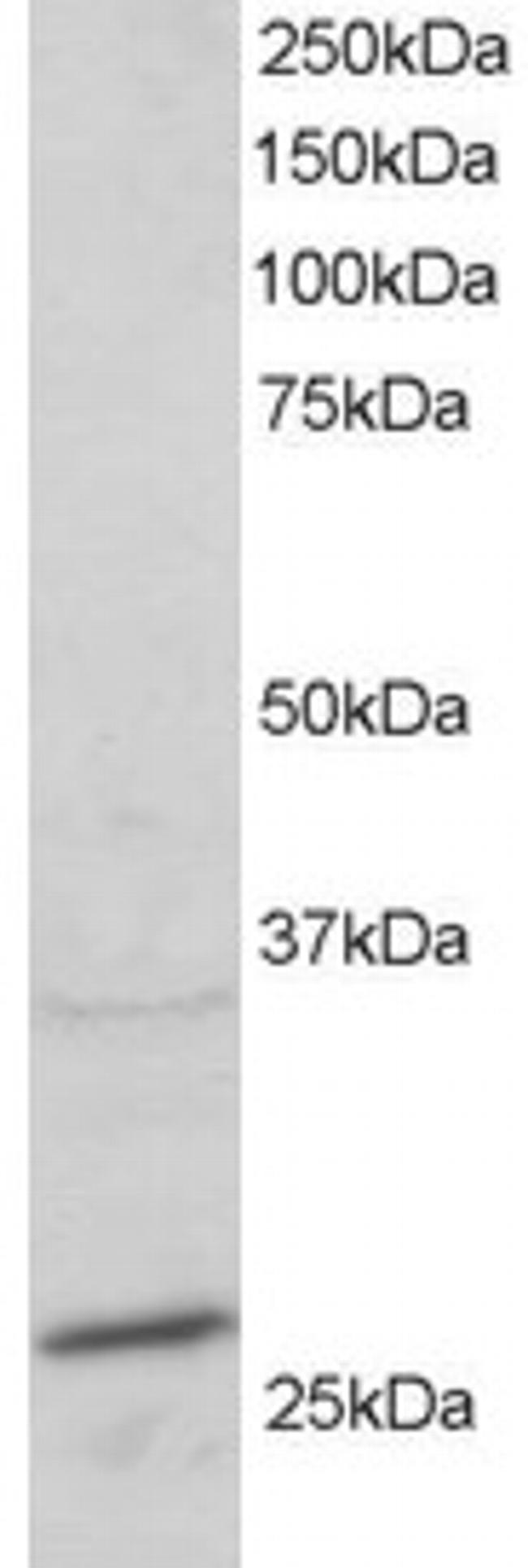 RAB11A Antibody in Western Blot (WB)